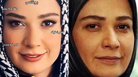 علت تغییر چهر فهمیه در پایتخت ۷ مشخص شد