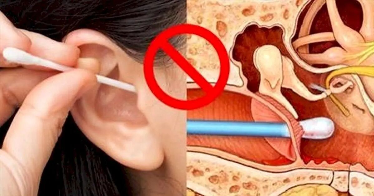 آیا می دانستید گوش‌پاکن‌های بازاری موجب آسیب به گوش می شوند؟