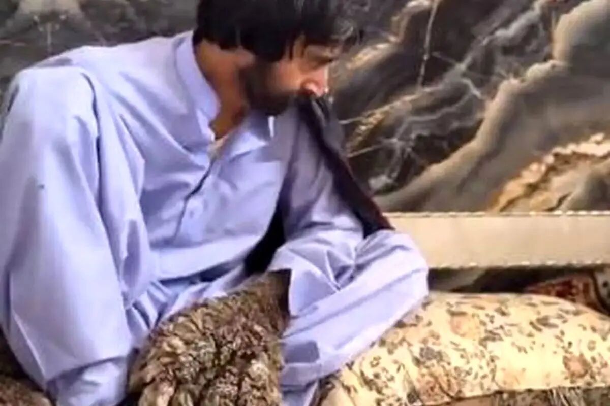 مرد درختی به چه بیماری مبتلاست؛ بهت علم پزشکی مقابل مردی از سیستان و بلوچستان