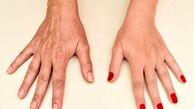 تست نیشگون، روشی ساده برای بررسی سن پوست دست؛ ۵ عادت روزمره که باعث پیری پوست می‌شوند