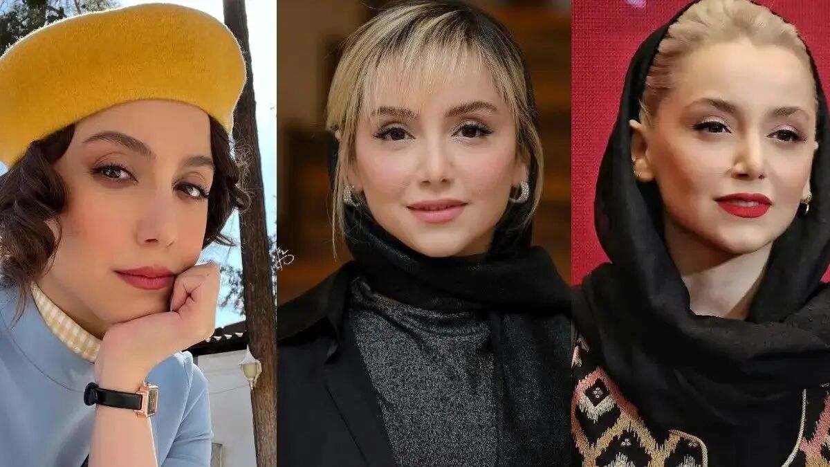 تغییر چهره عجیب نازنین بیاتی بعد از عمل جراحی؛ چی بوده، چی شده! + عکس