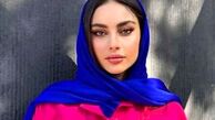 نگاه روز | تغییر چهره شگفت آور از ترلان پروانه