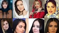 قبل و بعد عمل زیبایی بازیگران زن