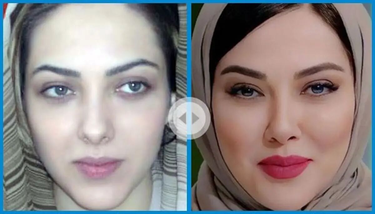 لیلا اوتادی قبل از عمل زیبایی