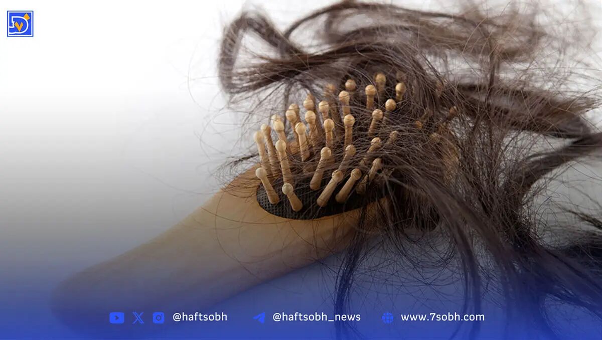 ۷ راهکار ساده و مؤثر برای جلوگیری از ریزش مو