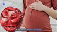 ضرورت مصرف مکمل آهن در بارداری