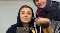 جدیدترین عکس نیوشا ضیغمی بعد از عمل دوباره بینی!