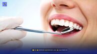 با این ویتامین‌ها دندان‌هایی سفید داشته باشید