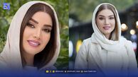 چهره قبل از عمل متین ستوده زن دوم کامران تفتی