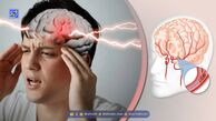 بهترین و موثرترین راه درمان سکته مغزی چیست؟