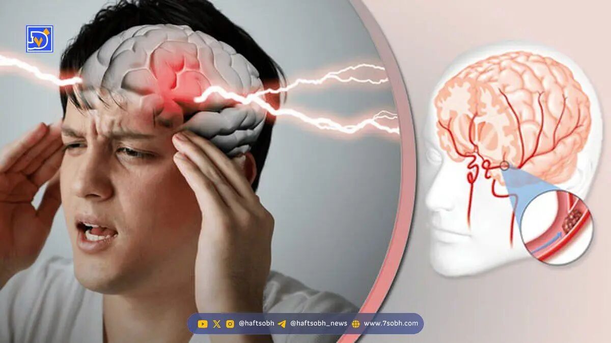بهترین و موثرترین راه درمان سکته مغزی چیست؟