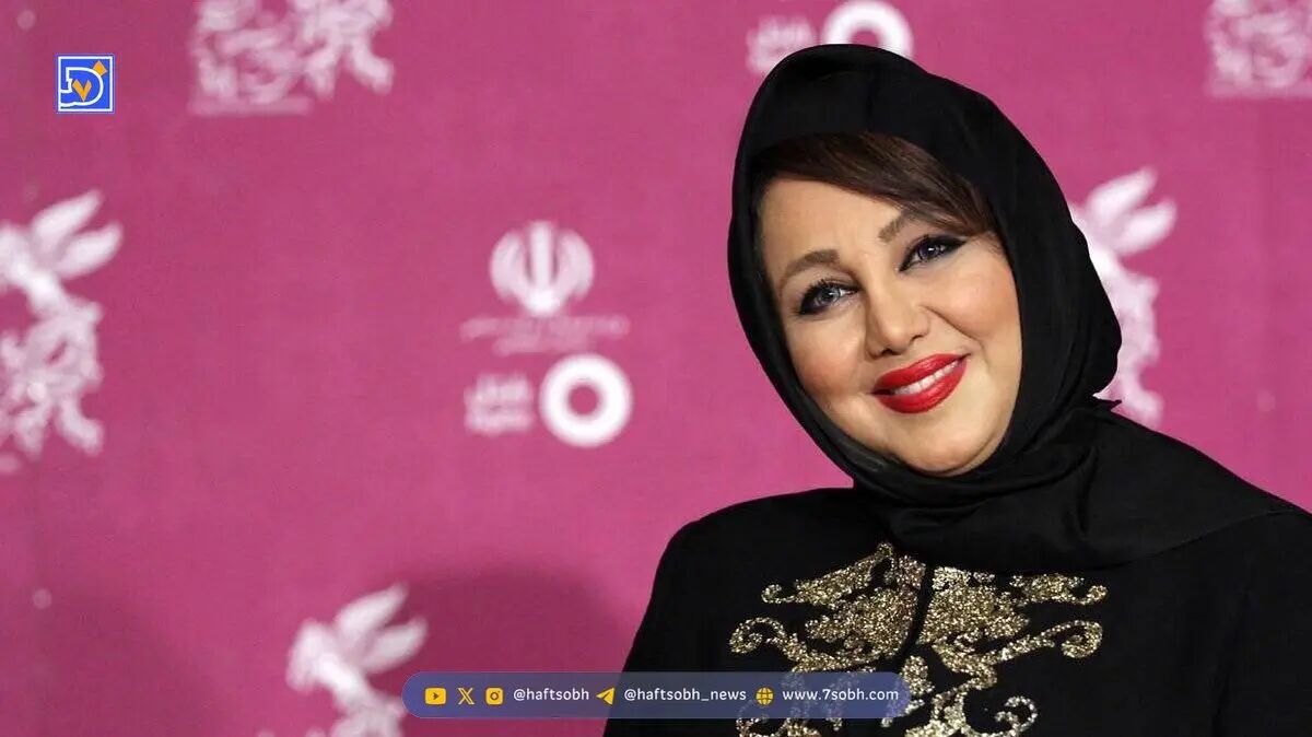 بهنوش بختیاری دده خانم سریال بامداد خمار قبل از عمل جراحی بینی / اصلاً قابل شناسایی نیست...