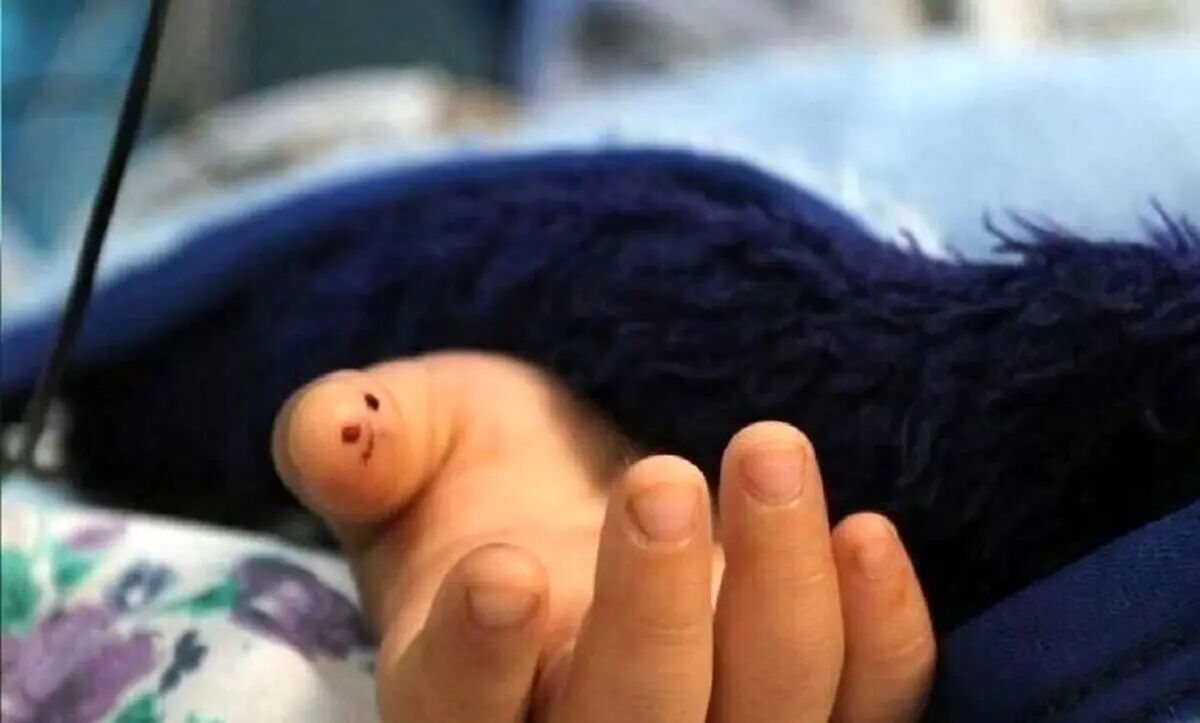 مرگ ۴۸ کودک به دلیل نبود مترجم