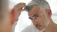 آیا استرس باعث سفید شدن مو می شود؟