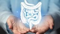 دلایل ابتلا به سرطان روده و راه‌های پیشگیری از این بیماری کشنده