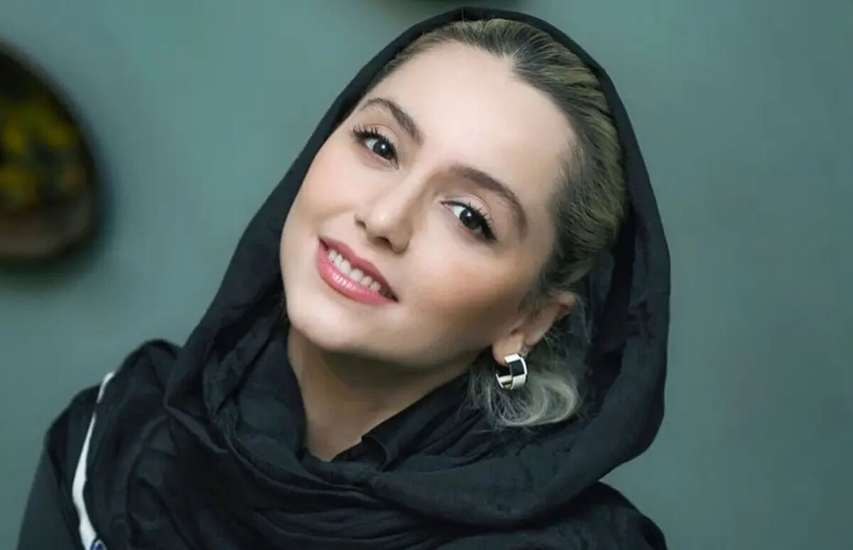 قبل و بعد نازنین بیاتی با جراحی زیبایی متعدد که باور نمیکنید!