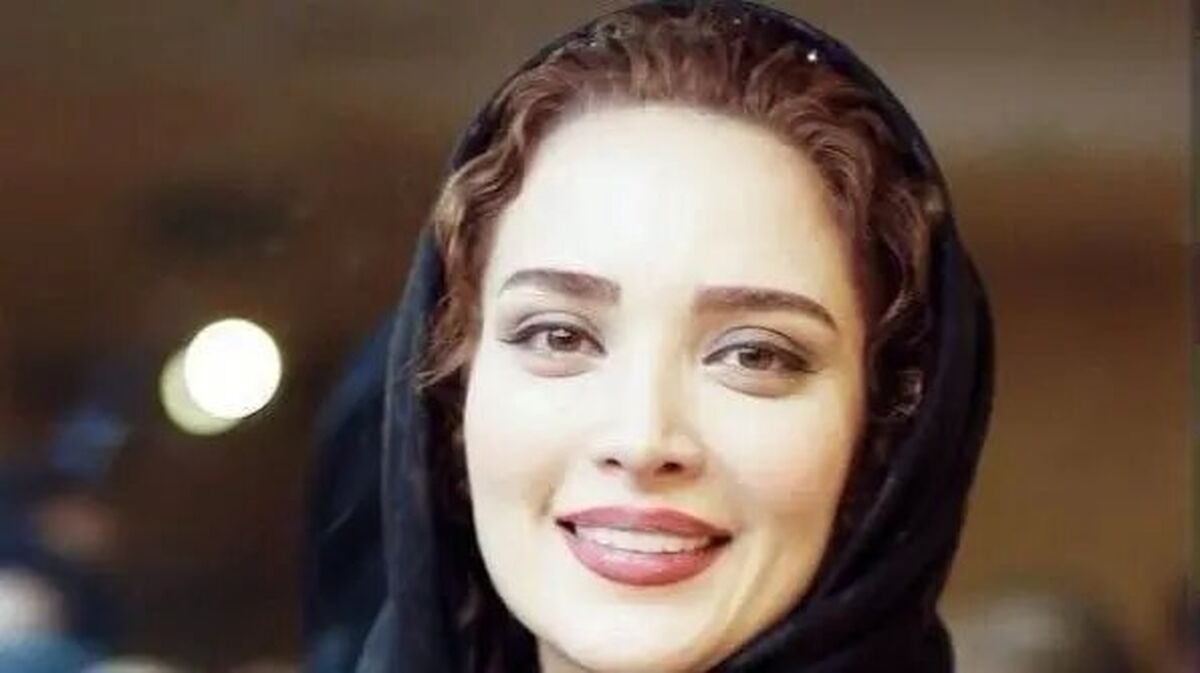 نقد و بررسی تغییر چهره بهنوش طباطبایی از چهره طبیعی تا عمل‌های زیبایی